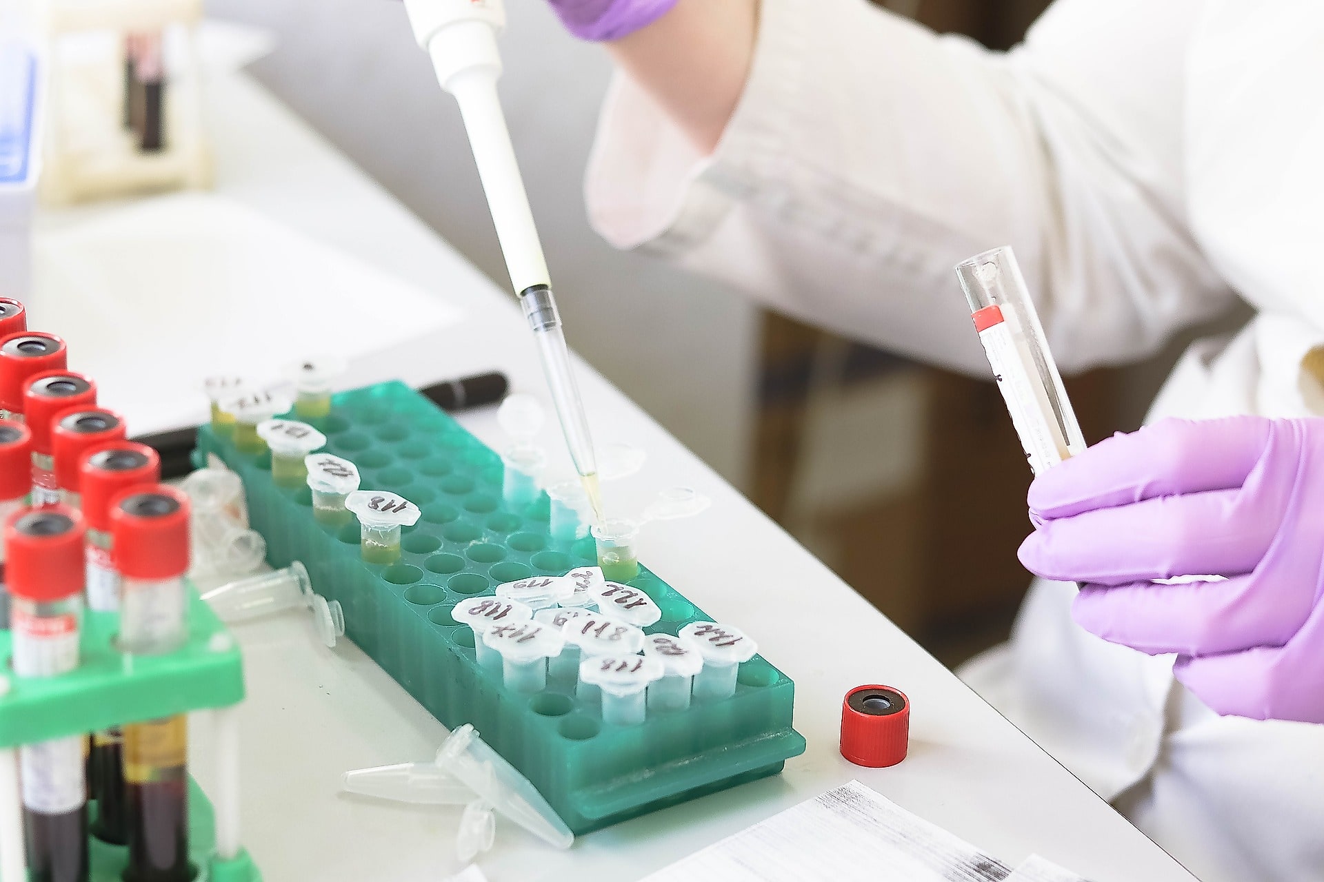Provette del prelievo di sangue nel laboratorio