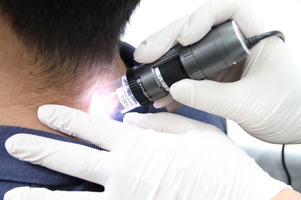 Controllo dermatologico con dermatoscopio